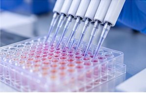 ELISA medical laboratory test photograph