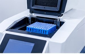 PCR medical laboratory test photograph