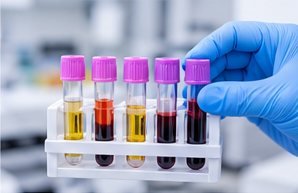 TFT medical laboratory test photograph