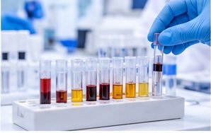 VDRL medical laboratory test photograph
